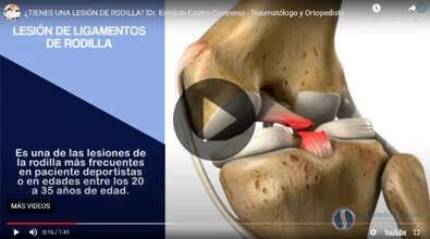 Lesión de Rodilla Dr. Esteban Castro Contreras - Traumatólogo y Ortopedista